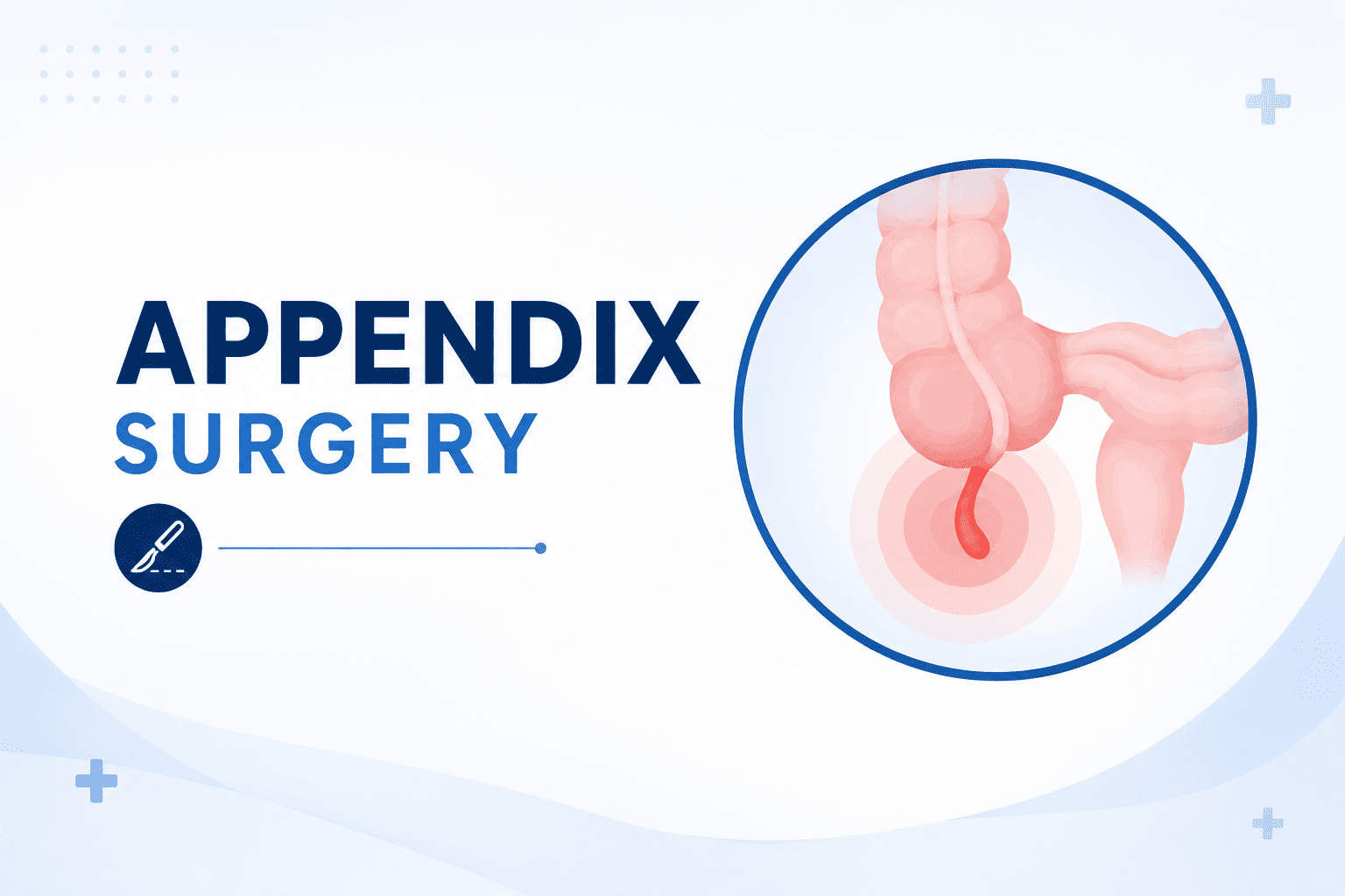 Best Doctor for Appendix Surgery in Andheri