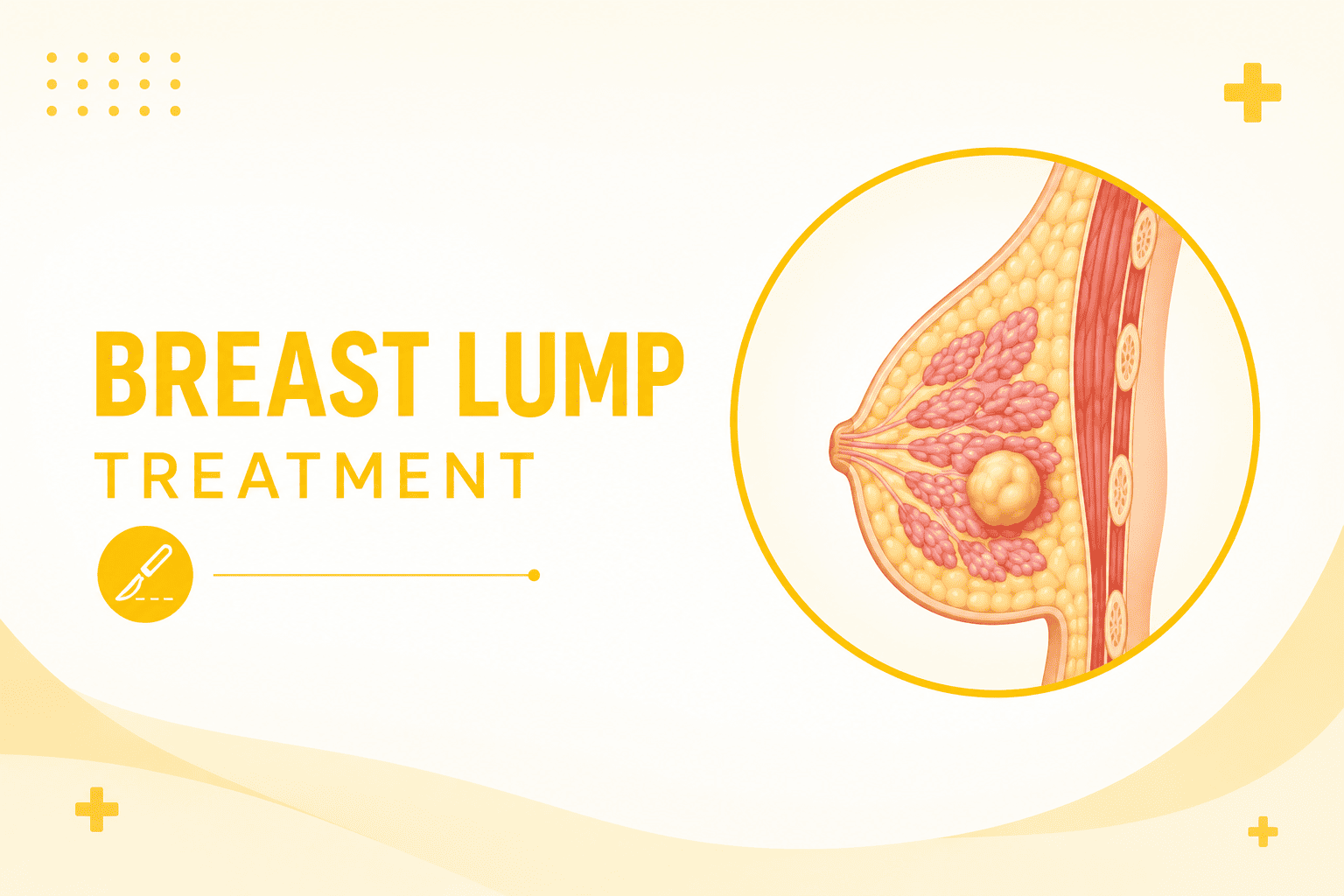 Best Doctor For Breast Lump Treatment in Goregaon
