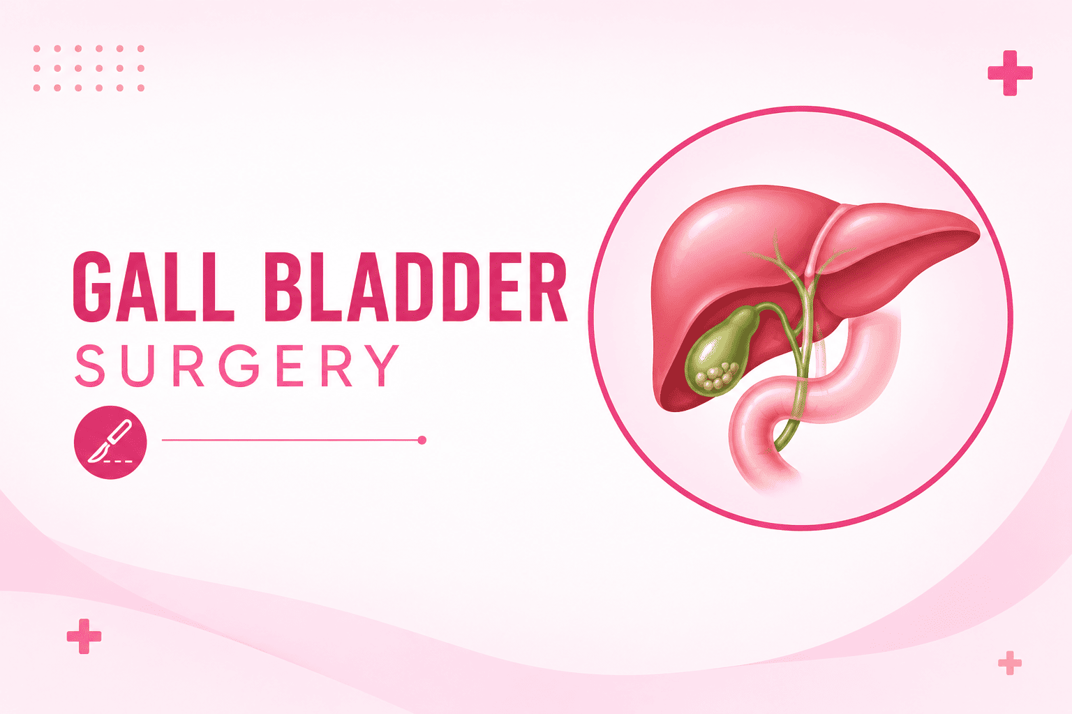 Best Gall Bladder Surgery in Andheri