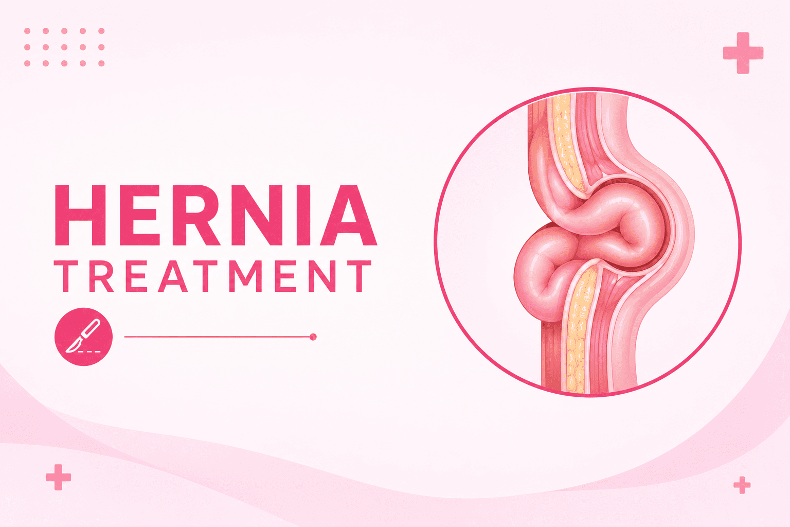 Best Hernia Treatment in Andheri