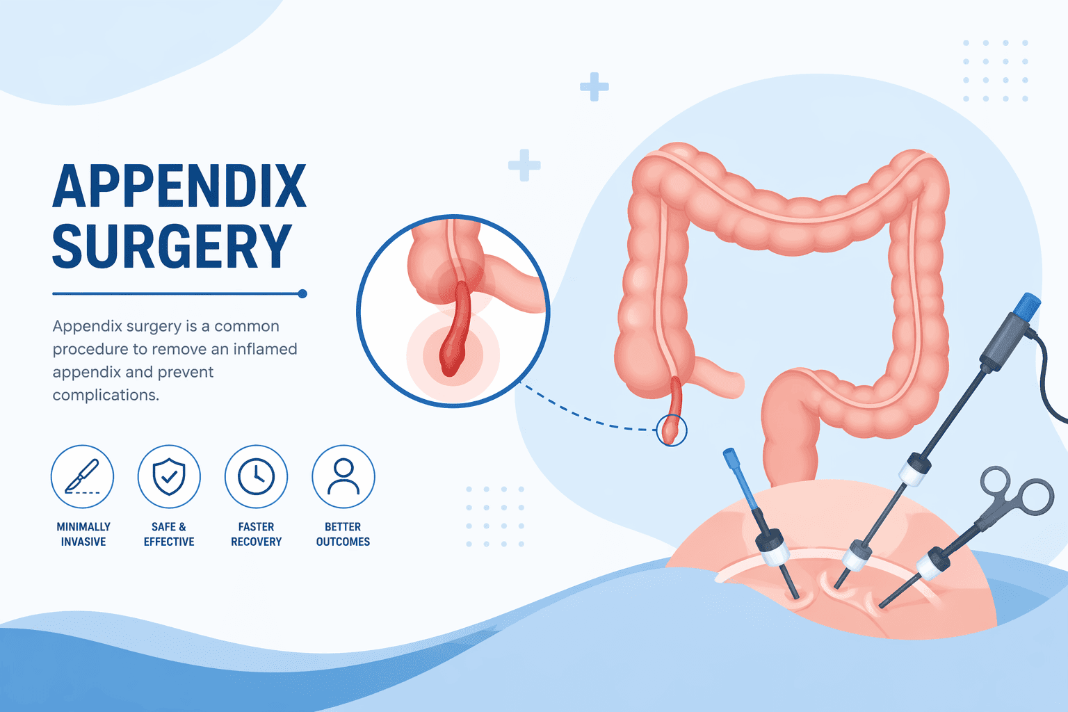 Best Doctor for Appendix Surgery in Goregaon