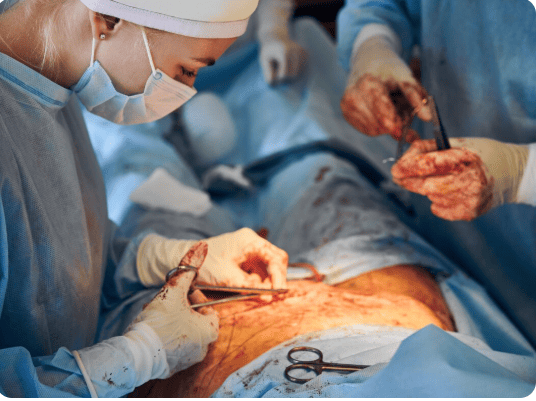 Best Gall Bladder Surgery in Goregaon